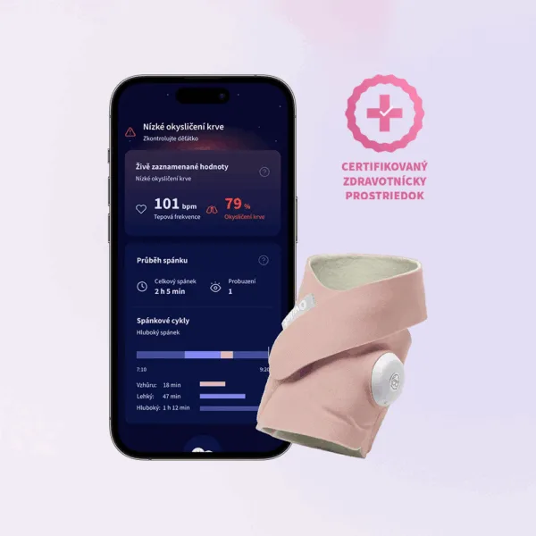 Owlet Dream Sock<sup>TM</sup> - Chytrá ponožka so zdravotníckou certifikáciou 0-18 mesiacov (Matne ružová)